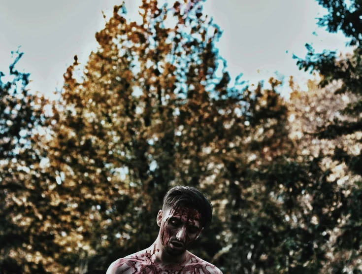 a man covered in blood standing in front of trees, pexels contest winner, realism, background image, zombie, colored photography, advertising photo
