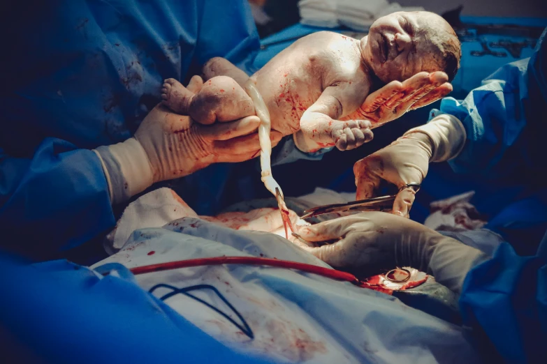 a close up of a person holding a baby, surgery, thumbnail, full body image, cruelty