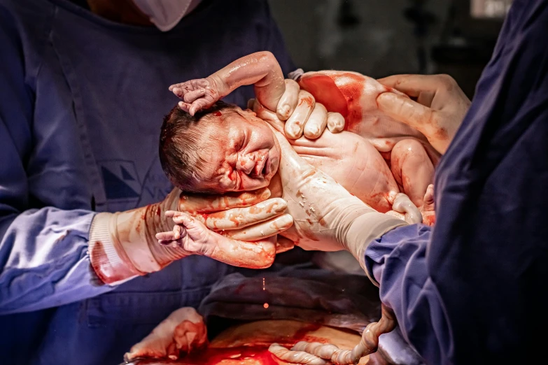a close up of a person holding a baby, surgery, lpoty, wtf, multi-part