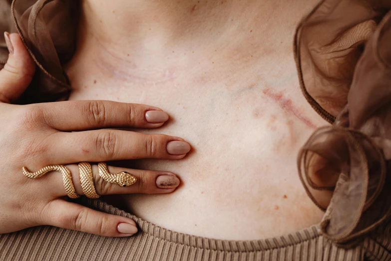 a woman with a snake ring on her chest, a tattoo, inspired by Elsa Bleda, trending on pexels, facial scar, scratched photo, white and gold kintsugi, background image