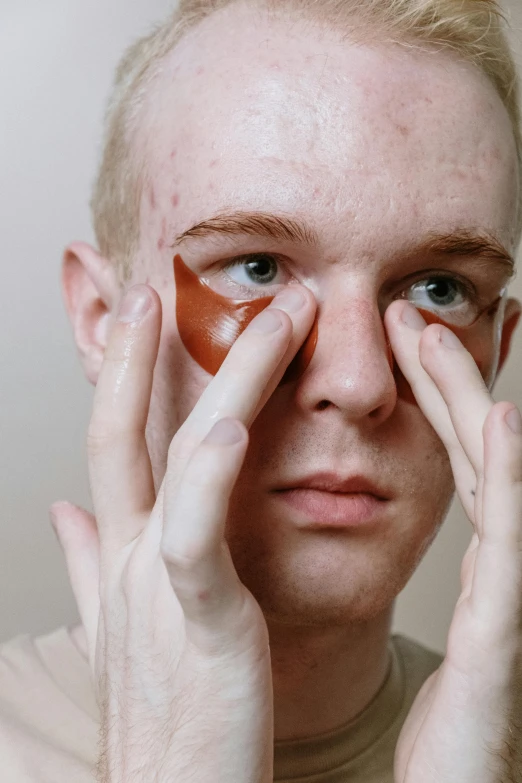a man with an eye patch on his face, an album cover, inspired by Leo Leuppi, trending on pexels, cinnamon skin color, hands on face, albino skin, oily skin
