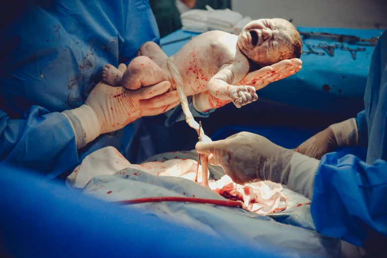 a close up of a person holding a baby, surgery, practical effects, thumbnail, full body image