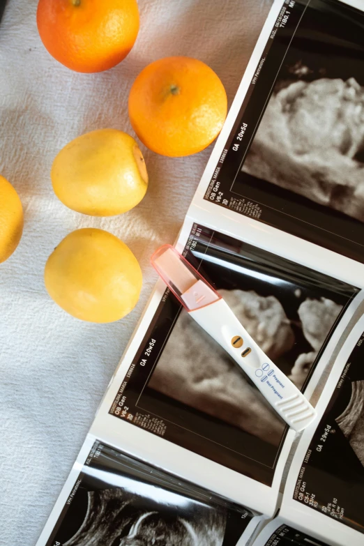 a couple of oranges sitting on top of a table, membrane pregnancy sac, professional high quality scan, white and yellow scheme, surgical supplies