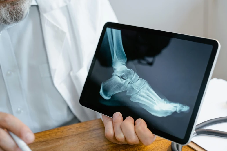 a doctor looking at an x - ray of a foot, a hologram, unsplash, using a magical tablet, fracture, schools, amateur photograph
