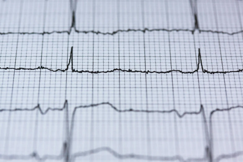 a close up of a person's ecg, a picture, pexels, square lines, interesting angle, performance, broken hearts