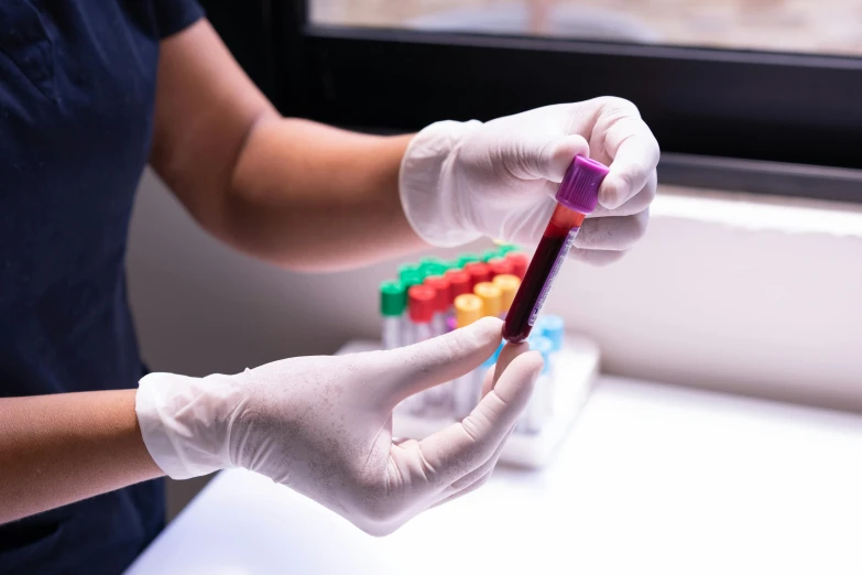 a close up of a person holding a cell phone, blood collection vials, purple and scarlet colours, colour corrected, thumbnail