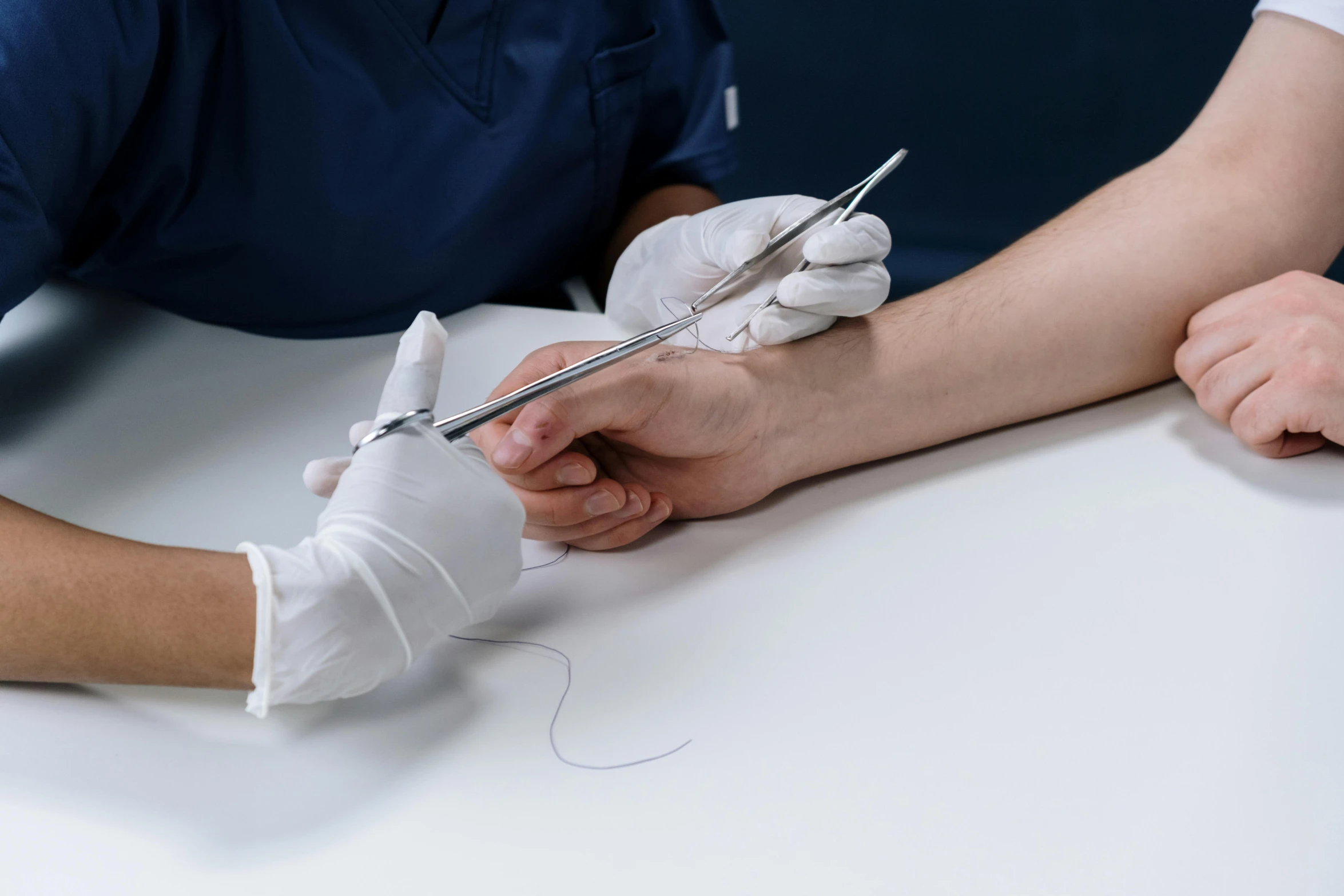 a person cutting a person's arm with a pair of scissors, dermal implants, thin wires, sitting on a lab table, unclipped fingernails