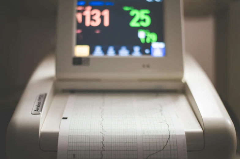 an ecg machine sitting on top of a table, pexels, happening, pregnancy, thumbnail, shot on sony a 7, plotter