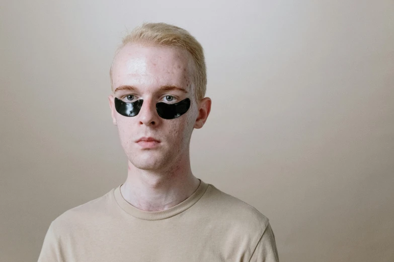 a man with a pair of sunglasses on his face, by Attila Meszlenyi, trending on pexels, photorealism, albino white pale skin, 1 7 - year - old boy thin face, an alien, totally black eyes