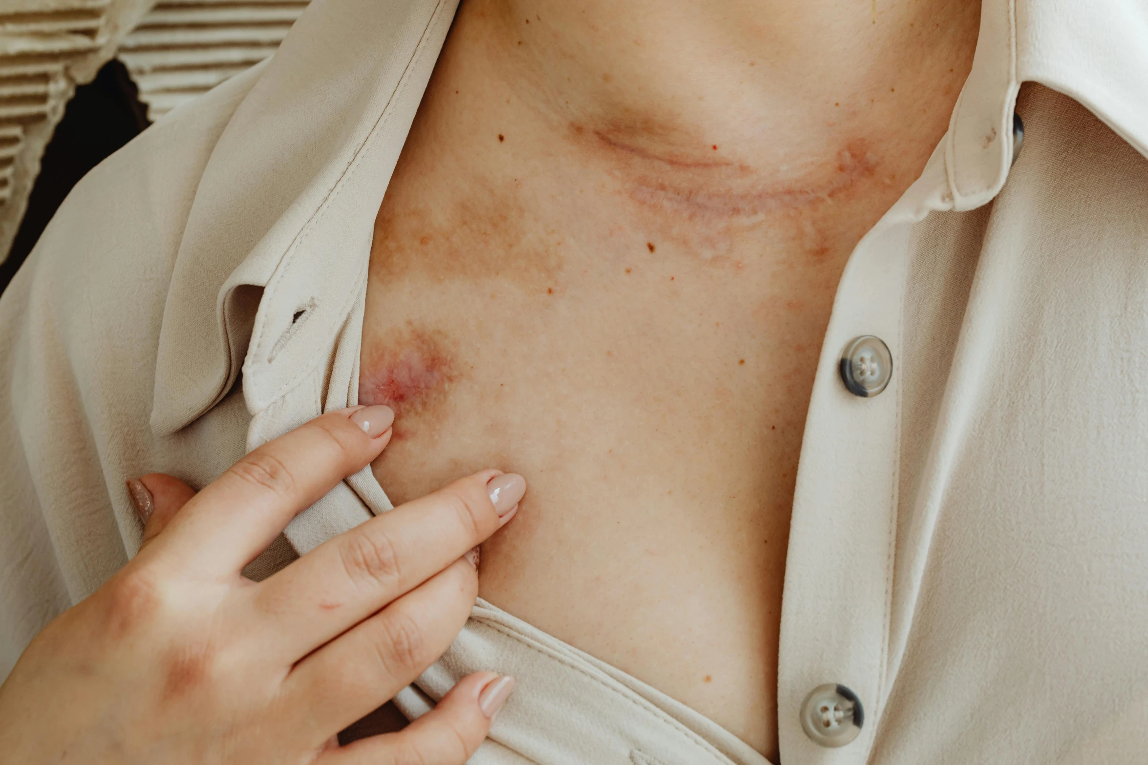 a woman holding a cell phone to her chest, a photo, inspired by Elsa Bleda, trending on pexels, figuration libre, facial scar, detailed veins, wearing a blouse, manuka