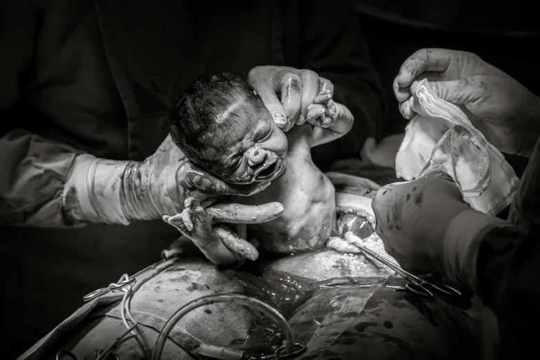 a black and white photo of a person holding a baby, a black and white photo, shutterstock contest winner, art photography, surgery, image credit nat geo, exploded belly, ash thorp khyzyl saleem