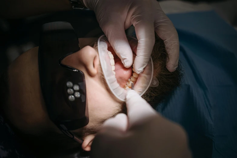 a man getting his teeth examined by a dentist, pexels contest winner, hyperrealism, translucent gills, thumbnail, cysts, with a spine crown