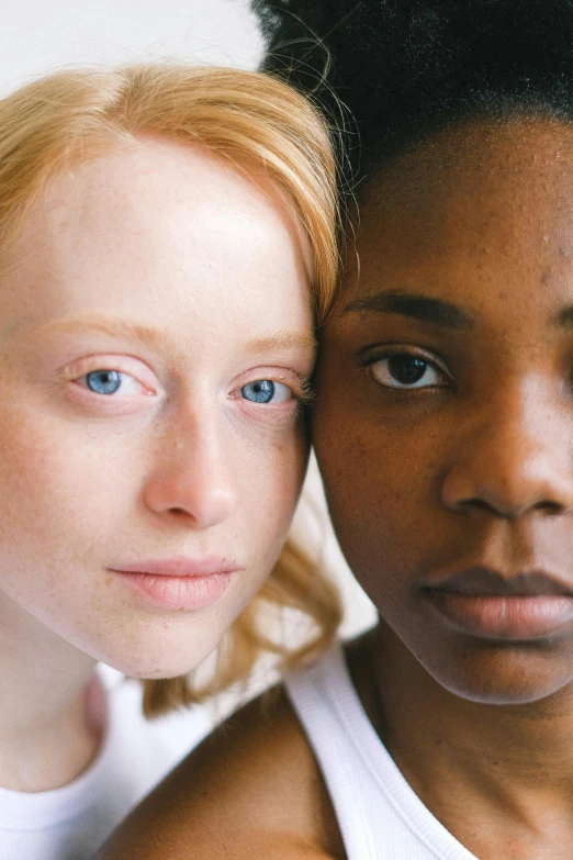 a couple of women standing next to each other, by Ellen Gallagher, trending on unsplash, renaissance, light freckles, black scars on her face, sadie sink, 2010s