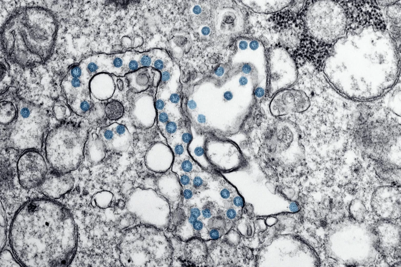 a group of cells with blue dots on them, a microscopic photo, by Ellen Gallagher, complex and desaturated, taken in 2 0 2 0, leaked, silver