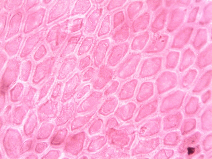 a close up of a piece of skin, a microscopic photo, flickr, ((pink)), clover, !female, reptilian skin