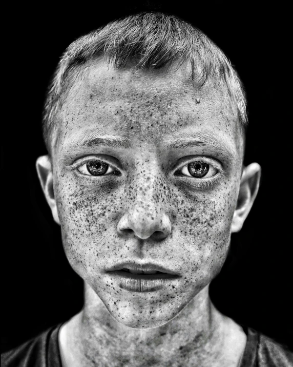 a black and white photo of a boy with freckles on his face, by Patrick Pietropoli, highly detailed saturated, very very very epic, flattened, portraiit