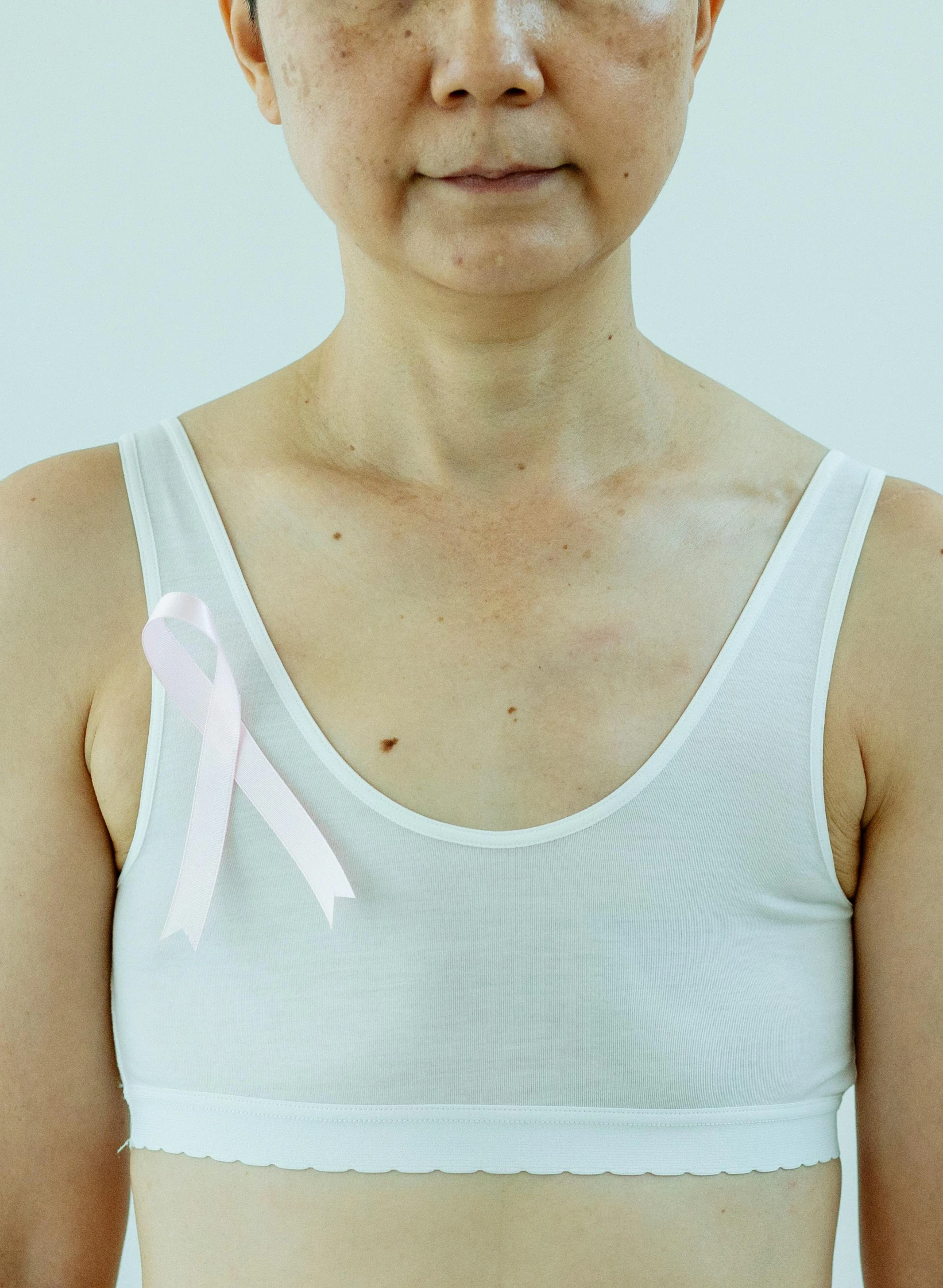 a woman with a pink ribbon on her chest, a photo, by Ellen Gallagher, medical image, scars, wearing : tanktop, white ribbon