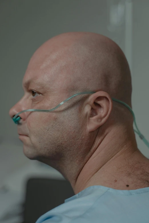 a close up of a person in a hospital bed, by Lee Gatch, hyperrealism, film still from god of war, profile image, bald, healthcare