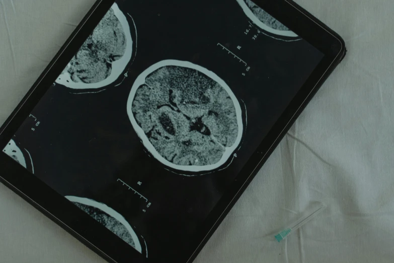 a tablet computer sitting on top of a bed, a black and white photo, pexels, computer art, brain surgery, pathology, broad strokes, on a wooden tray