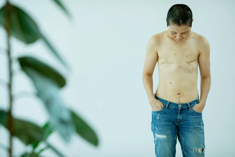 a shirtless man standing next to a potted plant, inspired by Zhang Kechun, unsplash, shin hanga, scales covering her chest, old scars, ( ( ( wearing jeans ) ) ), medical photography