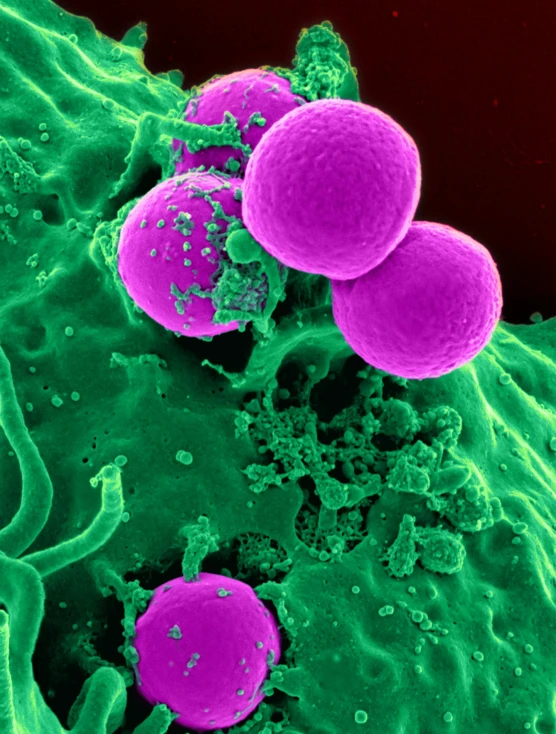 a close up of a purple and green cell, spores, infested with pitch green, viral, may)