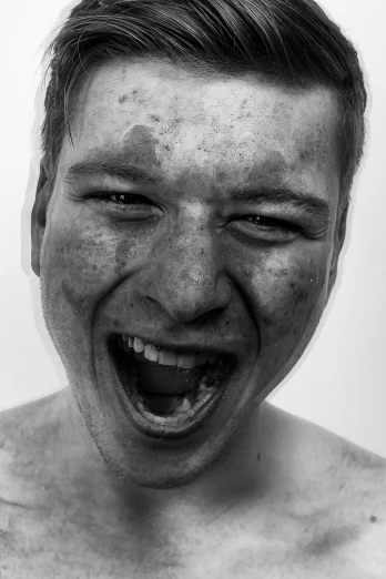 a black and white photo of a man making a face, an album cover, flickr, hyperrealism, laughter and screaming face, white freckles, he looks like tye sheridan, andrey surnov