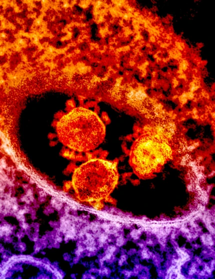 a close up of a cell in a cell phone, a microscopic photo, by Sebastian Vrancx, digital art, poster of corona virus, trio, ap press photo, (fire)