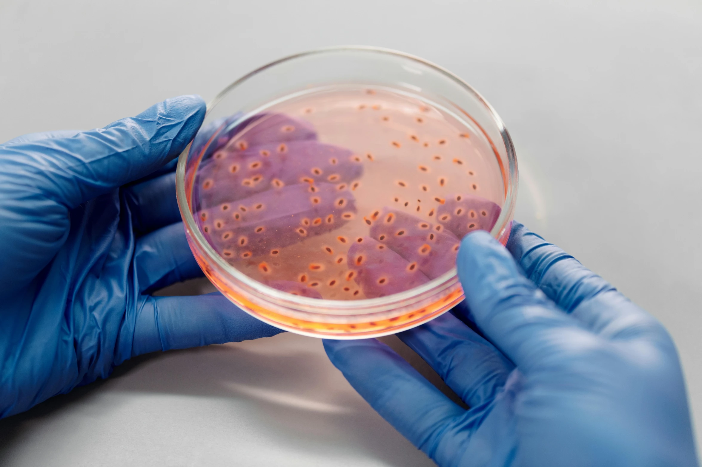 a person in blue gloves holding a petri dish, pink, fungal, detailed product image, pbr