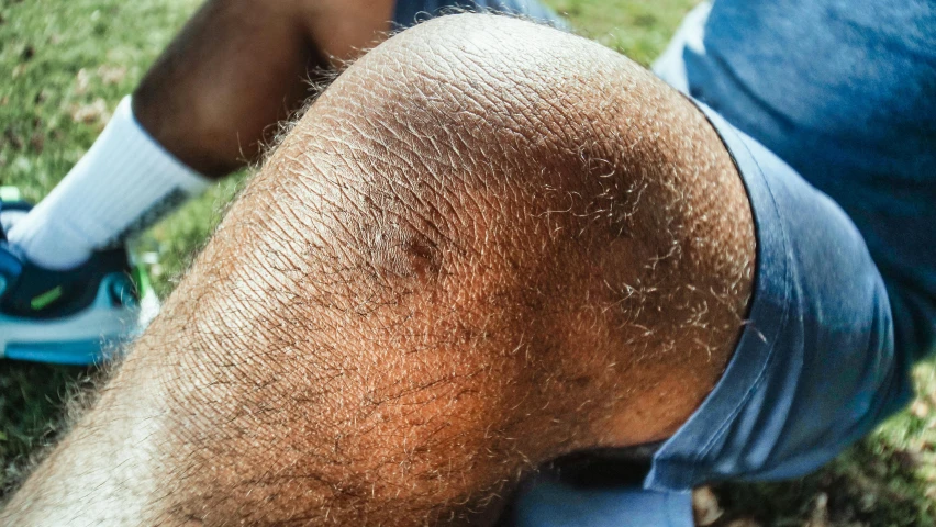 a man sitting on top of a lush green field, unsplash, looks like varicose veins, with brown skin, knobbly knees, closeup of sweating forehead