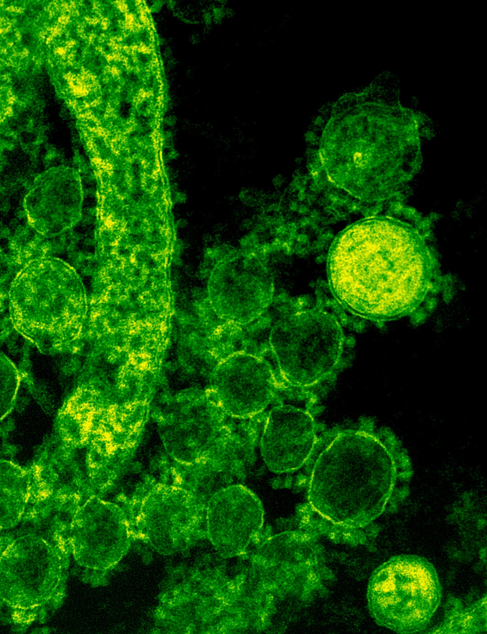 a close up of a green substance on a black background, a microscopic photo, by Micha Klein, renaissance, rna bioweapon, cute coronavirus creatures, bokeh ”, 2022 photograph