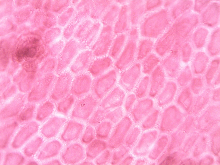 a close up of a piece of skin, a microscopic photo, flickr, ((pink)), !female, clover, detailed scan