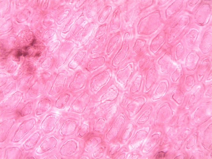 a close up of a piece of pink tissue, a microscopic photo, image dataset, kidneys, various posed, pink tigers