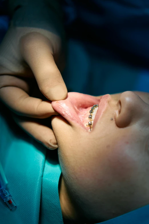 a close up of a person putting a tooth brush on a child's mouth, by Adam Marczyński, happening, hand transplanted to head, medical dissection, aged 13, an intricate