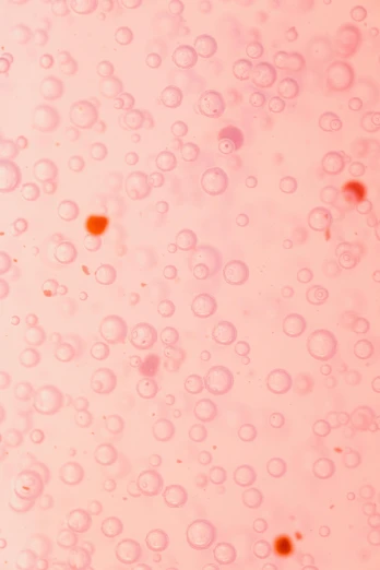 a close up of soap bubbles on a pink surface, a microscopic photo, flickr, red birthmark, jen atkin, sores, 2010s