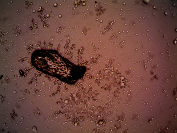 a close up of water droplets on a surface, a microscopic photo, by Alison Watt, hurufiyya, mole on cheek, 1 9 8 5 photograph, black mold, thumbnail