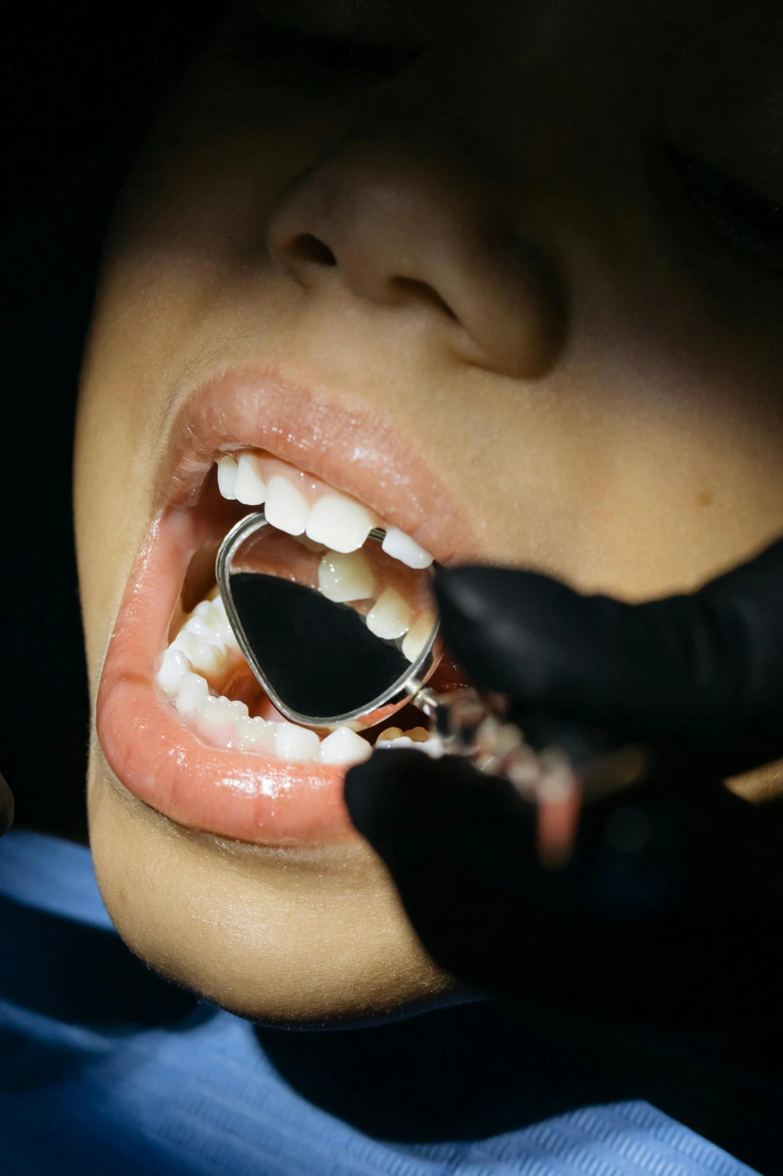 a woman getting her teeth examined by a dentist, shutterstock, hyperrealism, new emoji of biting your lip, chewing tobacco, jewelry, high angle close up shot