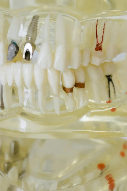 a close up of a tooth with toothbrushes in it, a digital rendering, reddit, renaissance, embedded in clear epoxy, miniature model, promo image, nerves