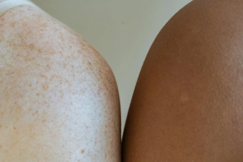 a close up of a woman's legs with freckles, by Carey Morris, trending on pexels, renaissance, two different characters, gradient brown to white, skincare, with brown skin