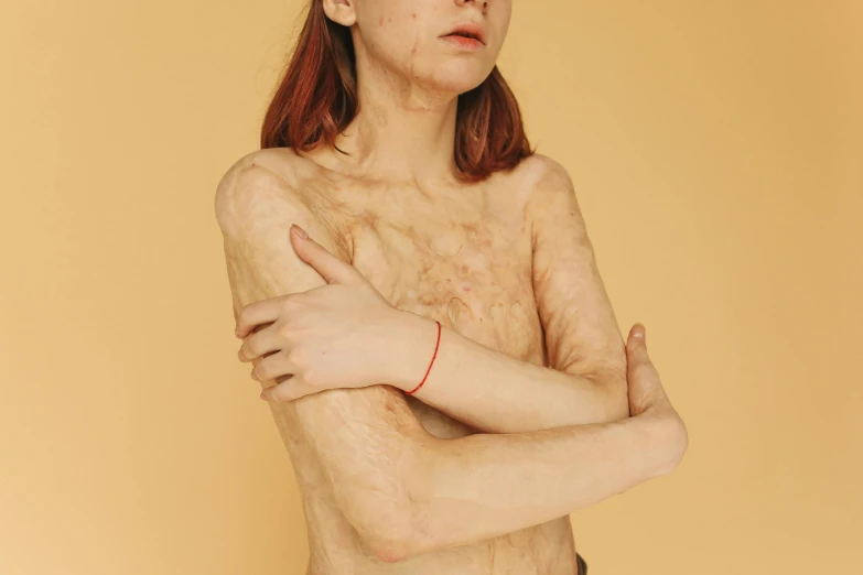 a naked woman standing with her arms crossed, inspired by Vanessa Beecroft, trending on pexels, hyperrealism, skin wounds, hairy orange skin, covered with wires, thin aged 2 5