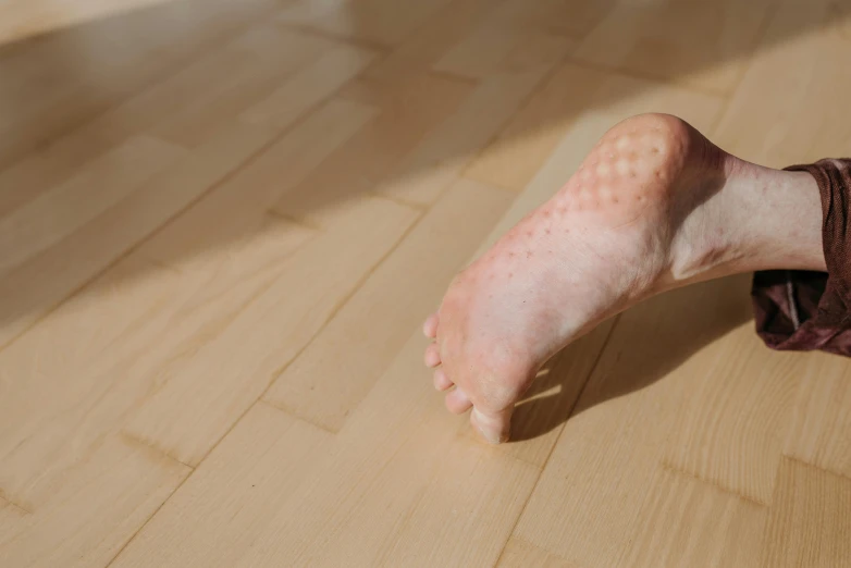 a close up of a person's foot on a wooden floor, pexels, hyperrealism, trypophobia acne face, photorealistic cgi, albino skin, ignant