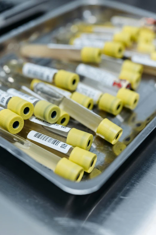 a tray of test tubes sitting on top of a table, yellow aureole, blood vesels, ap news, thumbnail