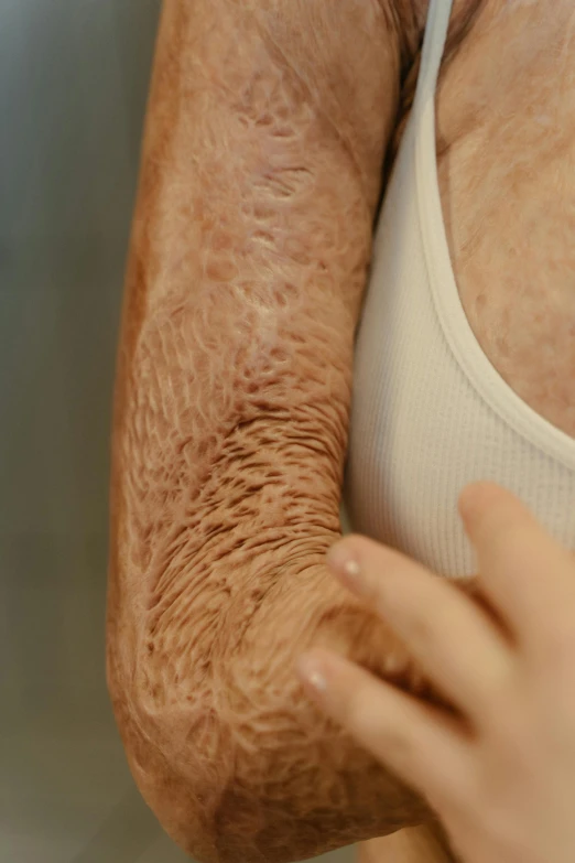 a close up of a person holding a child's arm, flawless epidermis, tubes fused with the body, wrinkled, of a full body