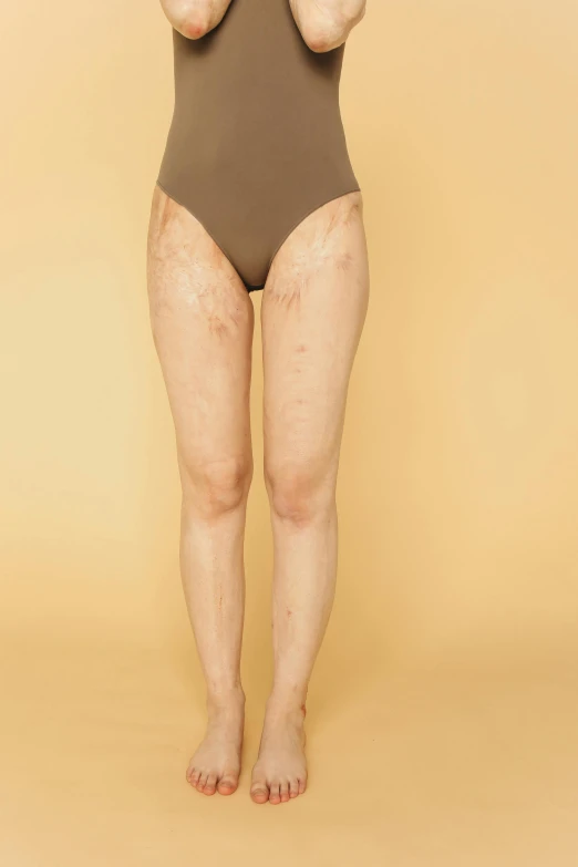 a woman in a bodysuit posing for a picture, an album cover, unsplash, shin hanga, looks like varicose veins, bruised, transparent, dirty clothes
