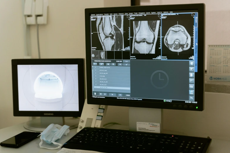 a computer monitor sitting on top of a desk, medical imaging, knee, multi-part, brown