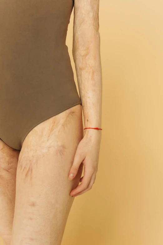 a woman in a bodysuit posing for a picture, an album cover, by Ellen Gallagher, trending on pexels, conceptual art, red birthmark, muted arm colors, with wires and bandages, detail shot