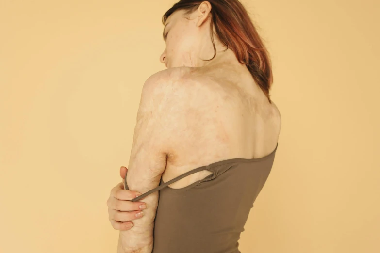 a woman standing with her back to the camera, trending on pexels, renaissance, emaciated, brown scales, injured, veins