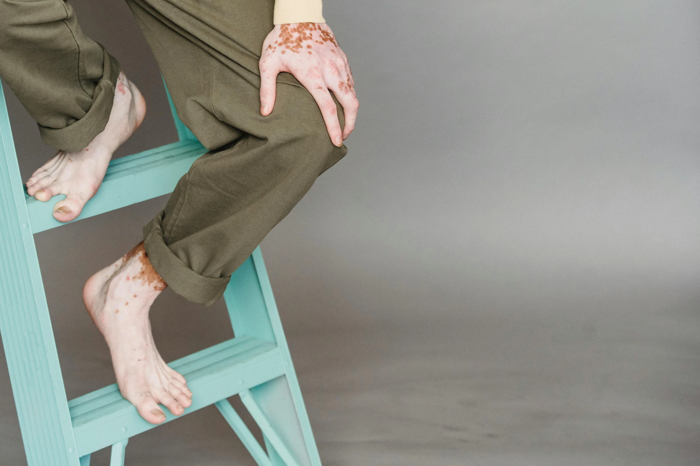 a woman sitting on top of a blue step stool, trending on pexels, hyperrealism, all dirty with severed limbs, green and brown clothes, freckled pale skin, sitting on man's fingertip