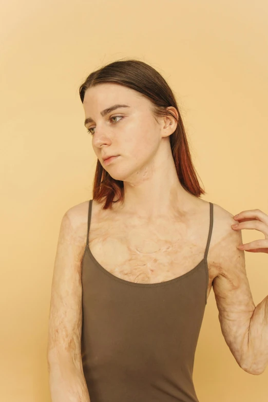 a woman in a tank top posing for a picture, an album cover, inspired by Elsa Bleda, trending on pexels, human skin texture, emaciated, clothes made out of veins, skincare