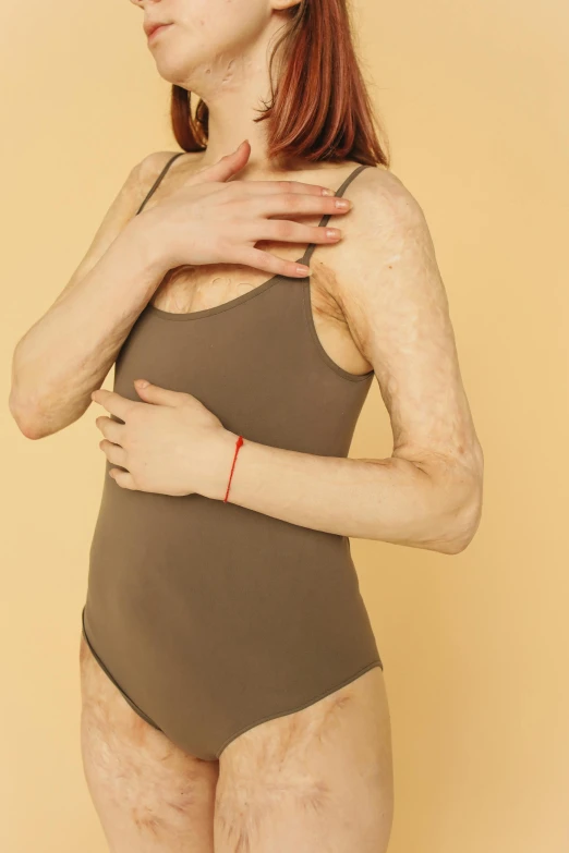 a woman in a bodysuit posing for a picture, an album cover, inspired by Vanessa Beecroft, trending on pexels, with damaged rusty arms, marfan syndrome, hairy arms, woman with freckles