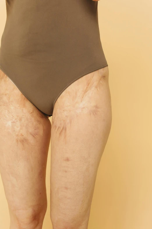 a close up of a person in a bodysuit, an album cover, by Ellen Gallagher, trending on pexels, looks like varicose veins, stained dirty clothing, full view blank background, human-skin pelt